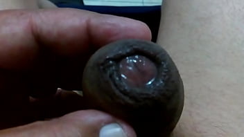私のチンポは発疹でたくさんよだれを垂らしています。これを見てください!!!