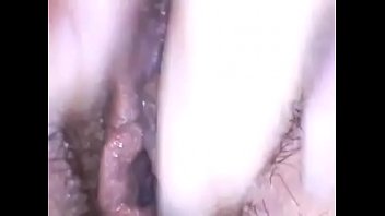 의료 내시경과 아름다운 털이 음부를 탐험