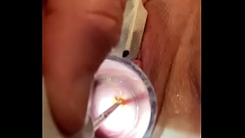 筋肉のけいれん子宮頸部の電気音泣く痛み