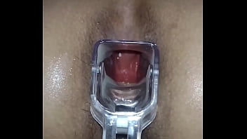 They insert speculum in the ass of a young amateur Latina